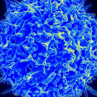 Archivo - Imagen de micrografía de un linfocito T humano del sistema inmunitario.