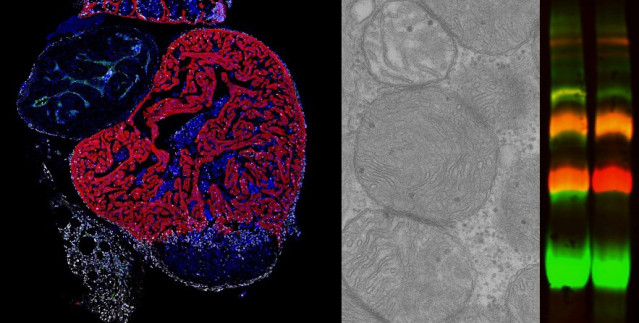 De izquierda a derecha: Immunofluorescencia en sección de corazón de pez cebra tras criolesion mostrando células proliferativas (blanco), cardiomiocitos (rojo) núcleos celulares (azul). Imagen de Microscopia electrónica mostrando mitocondrias.