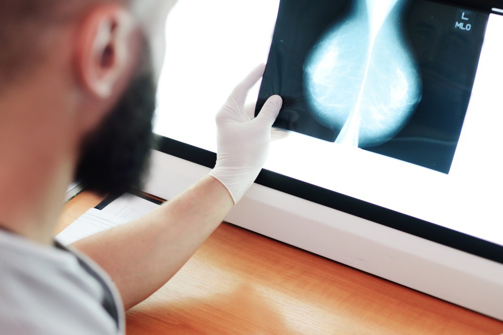 El 85% las pacientes con cáncer de mama considera que la inversión ...