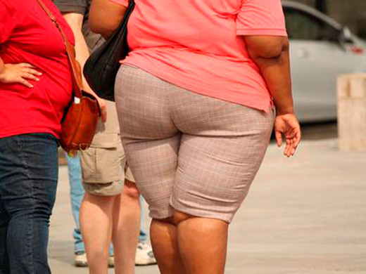 Obesidad mujer