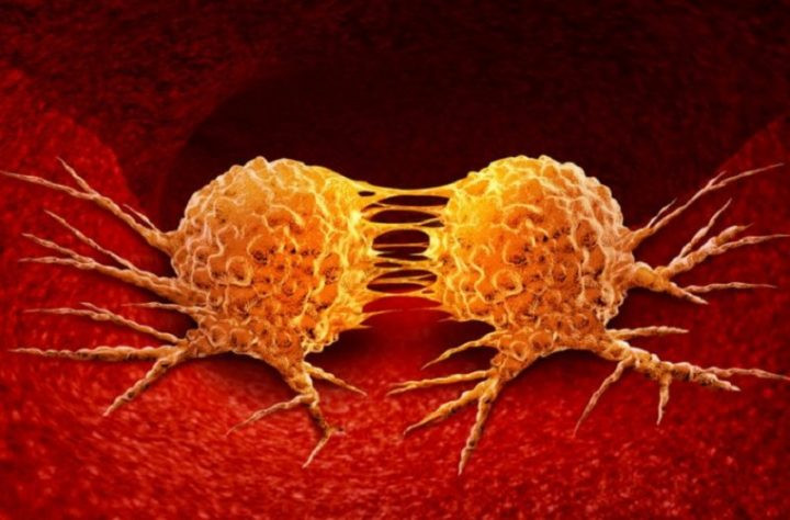 Metastasis