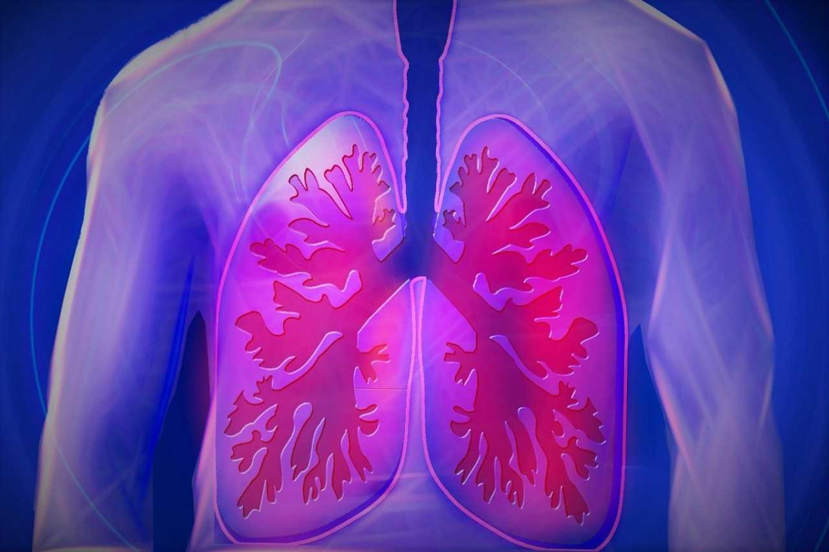 Fibrosis pulmonar