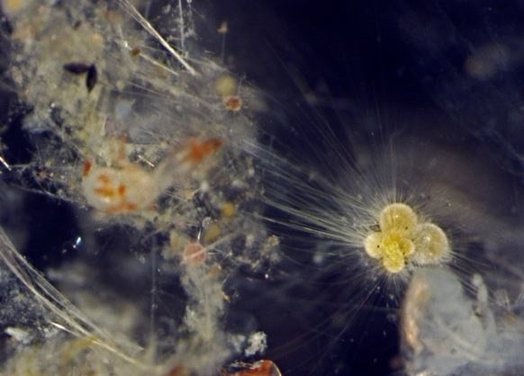 Imagen al microscopio óptico de materia orgánica marina recogida con una red de plancton en el suroeste del océano Índico.