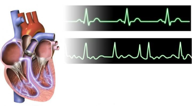 Archivo - Corazón, electrocardiograma, cardiaco