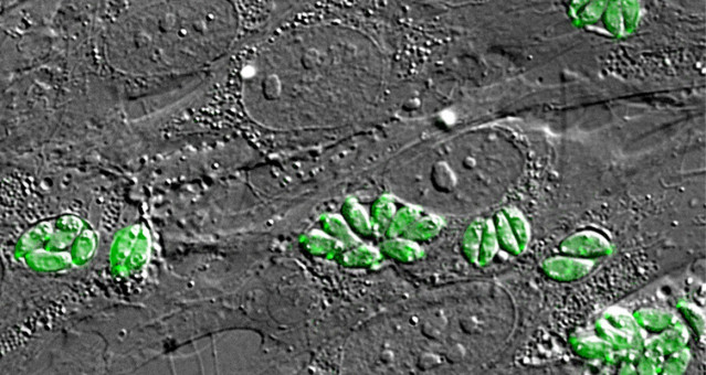 Archivo - Imagen intracelular al microscopio del parásito Toxoplasma gondii, causante de la toxoplasmosis, dentro de fibroblastos humanos.