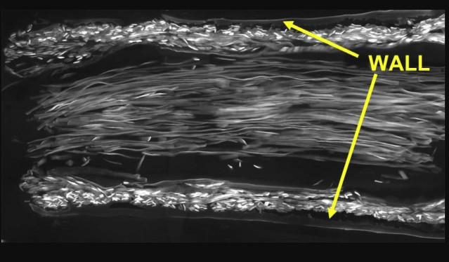 Imagen de microscopio electrónico de barrido de una sección longitudinal a través de un conducto de seda que contiene fibras de seda luminal que guían los nervios.