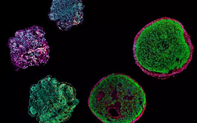 Estos 'epicardioides' -organoides fabricados a partir de células madre pluriopotentes- miden sólo 0,5 milímetros. Los investigadores pueden utilizarlos para imitar el desarrollo del corazón humano en el laboratorio y estudiar cardiopatías hereditarias.