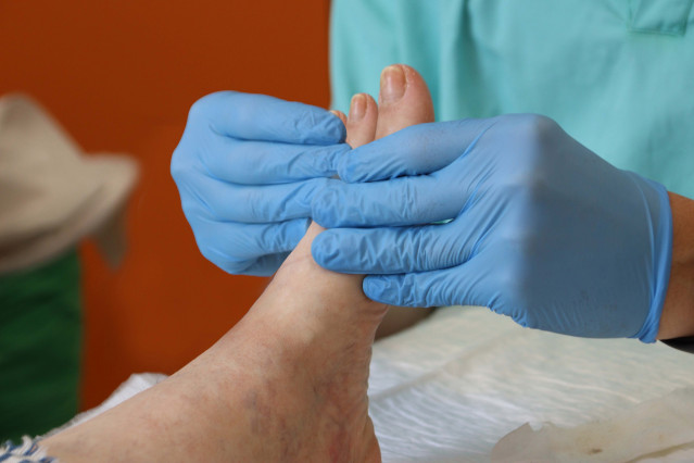 Archivo - Pies, fascitis plantar