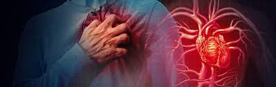 Infarto al miocardio