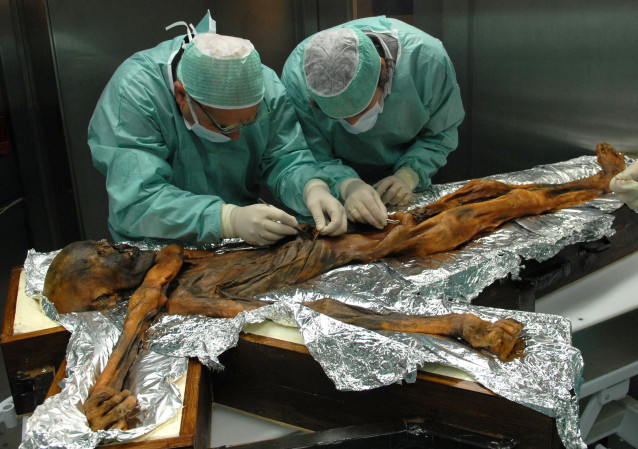 Archivo - Científicos analizan el cuerpo de Otzi,