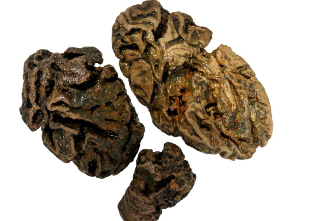 Fragmentos de cerebro de un individuo enterrado en un cementerio victoriano (Bristol, Reino Unido), hace unos 200 años.