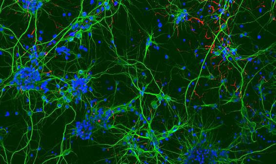 Las redes neurales crecen bajo campos magnéticos alternos de alta frecuencia.