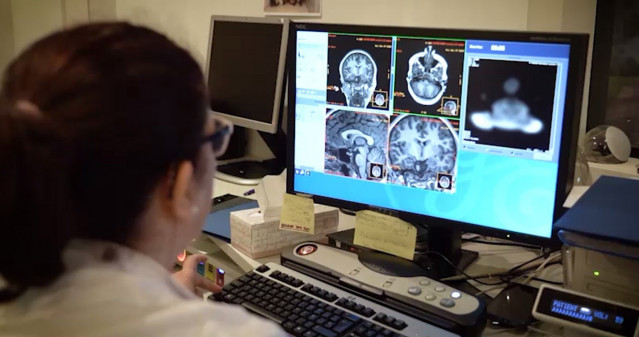 Detectan con un análisis de sangre un mecanismo clave en el desarrollo del Alzheimer
