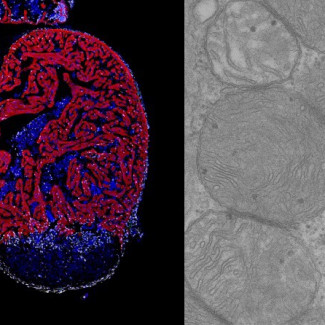 De izquierda a derecha: Immunofluorescencia en sección de corazón de pez cebra tras criolesion mostrando células proliferativas (blanco), cardiomiocitos (rojo) núcleos celulares (azul). Imagen de 