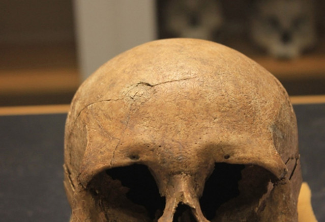 Del estudio esquelético vikingo: Un cráneo que muestra un traumatismo contundente con líneas irradiadas.