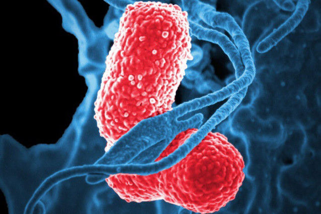 Archivo - Los glóbulos blancos (azul) atacan a dos bacterias 'Klebsiella' (rosa) en esta imagen microscópica electrónica de barrido coloreada.