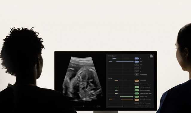 Software de detección de cardiopatías congénitas de BrightHeart.
