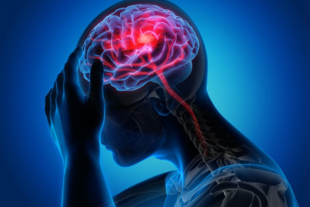 Archivo - Epilepsia