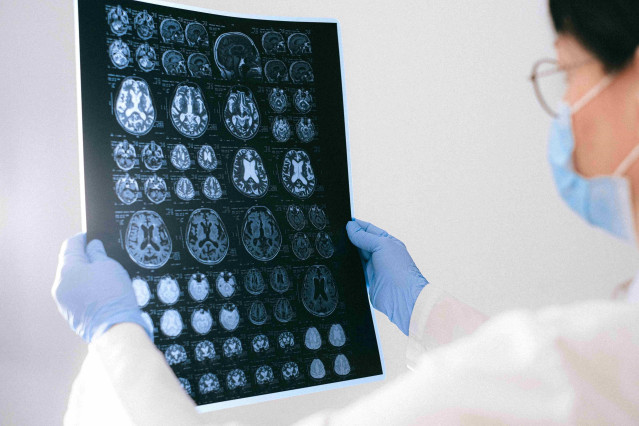Epilepsia