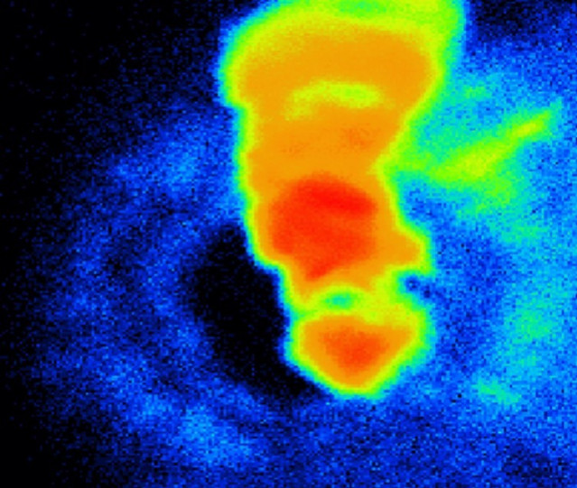 Hierro triturado bajo el microscopio