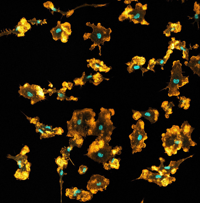 Archivo - Macrófagos de ratón visualizados en imagen de microscopio confocal. Los núcleos se ven en azul y la red de actina en naranja.