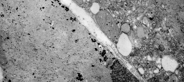 Archivo - ?Imagen al microscopio de un enterovirus de la familia Coxsaquievirus