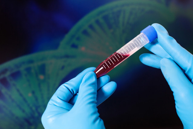 Archivo - La SETH apuesta por 'acuerdos innovadores' para abordar el precio del nuevo fármaco contra la hemofilia