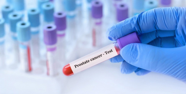 Una uróloga advierte de que el dolor óseo en hombres mayores es una 'señal silenciosa' de cáncer de próstata metastásico