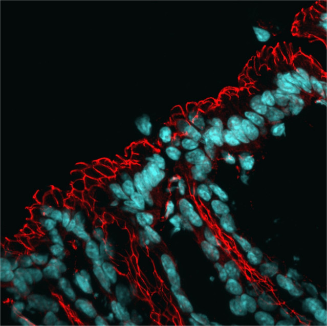 Microscopía del intestino, con los núcleos teñidos en azul y la red de proteínas de barrera en rojo.