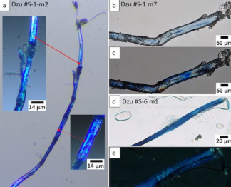 Las fibras teñidas de azul, como se ven bajo un microscopio confocal