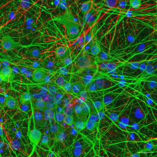 Cultivo 2D de células neuronales corticales (de cerebro): neuronas (verde) y células de glía (rojo). Laboratorio Facultad de Ciencias Biológicas UCM.