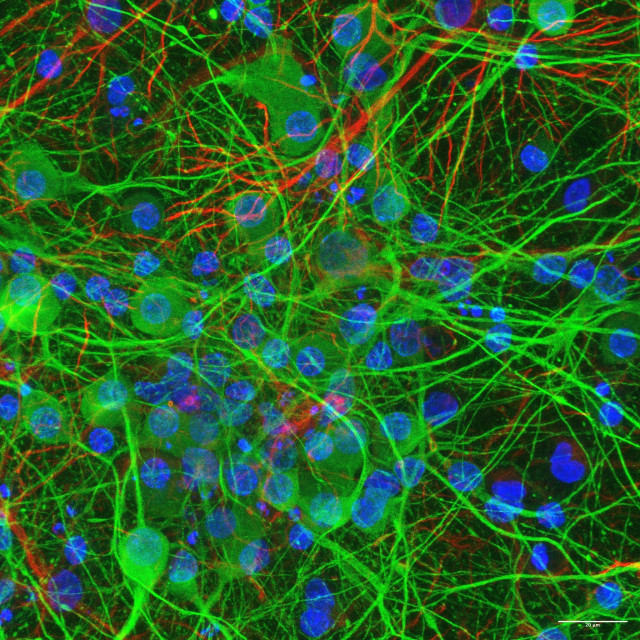 Cultivo 2D de células neuronales corticales (de cerebro): neuronas (verde) y células de glía (rojo). Laboratorio Facultad de Ciencias Biológicas UCM.