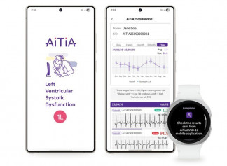 Monitorización de la disfunción sistólica ventricular izquierda en un reloj Galaxy