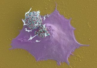 Imagen de microscopía coloreada de los microdispositivos (esferas): uno en contacto con la membrana de la célula y otro en el interior.