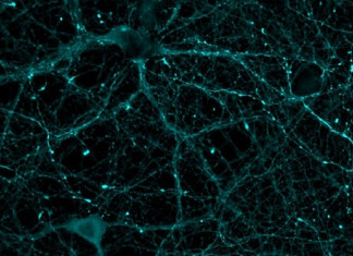 Imagen de microscopía con neuronas teñidas con marcadores estudiados en este trabajo. /