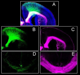 Archivo - La ausencia del receptor CB1 en el desarrollo embrionario altera la formación de la corteza prefrontal