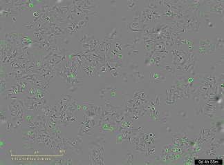 La imagen representa las células de cáncer muertas al activarse su proteína de membrana PAR-1 por la proteasa bacteriana HapA.