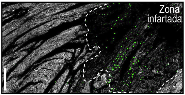 Localización de neutrófilos “nocturnos” (en verde) dentro del área de infarto en el miocardio (zona oscura rodeada por la línea blanca).