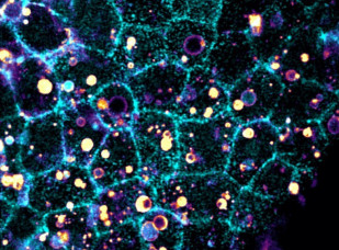 Imagen del tejido epitelial de un embrión (celeste) y células ingeridas que han sido fragmentadas (amarillo).