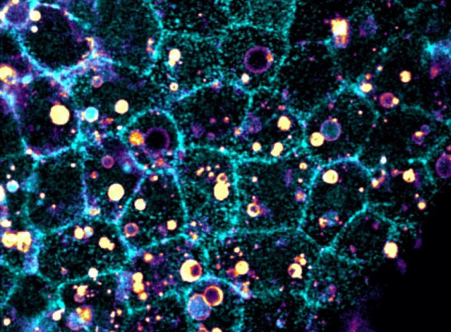 Imagen del tejido epitelial de un embrión (celeste) y células ingeridas que han sido fragmentadas (amarillo).