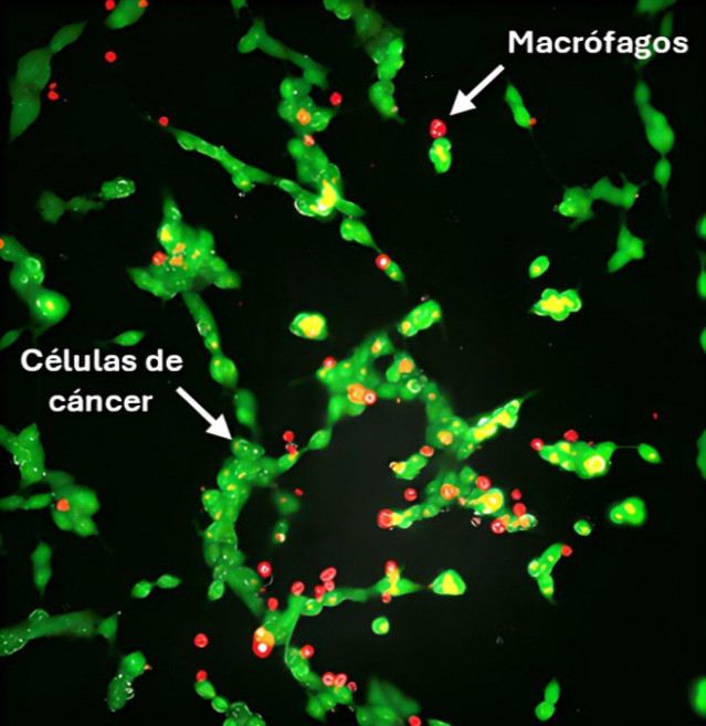 Microscopía electrónica de células de cáncer de neuroblastoma tratadas inicialmente con liposomas y posteriormente macrófagos modificados con liposomas.