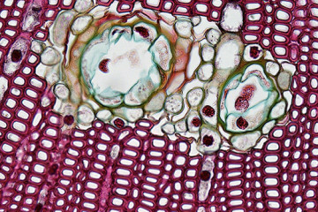 Celulas cancerigenas