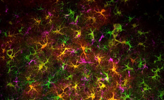 Archivo - Un grupo reducido de células interviene en la pérdida de memoria por cannabis en adolescentes