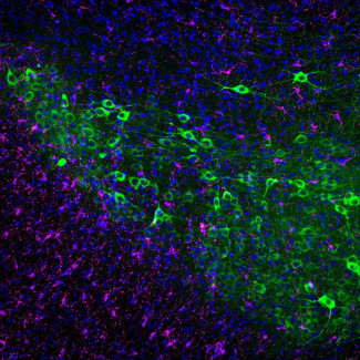 En verde, neuronas dopaminérgicas de ratón; en magenta, microglia; y en azul, núcleos celulares.