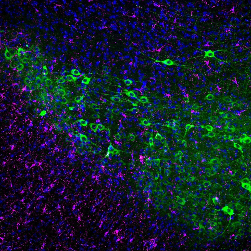 EuropaPress 7261380 verde neuronas dopaminergicas raton magenta microglia azul nucleos