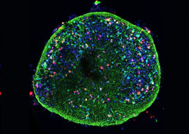 Alteraciones celulares del Alzheimer, observadas también en cultivos de neuronas infectadas por virus del herpes labial