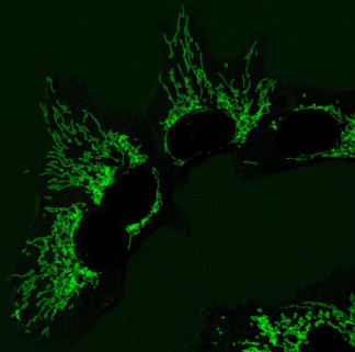 Imagen de microscopía de fluorescencia de las mitocondrias en células humanas sanas, que ayudan a producir los componentes básicos del ADN.