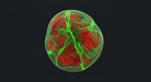 Un estudio expone que células leucémicas muestran una 'huella' tras atravesar tejidos que altera su núcleo y funciones