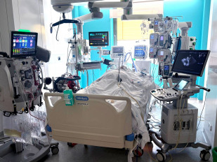 Canulación de paciente con soporte ECMO.