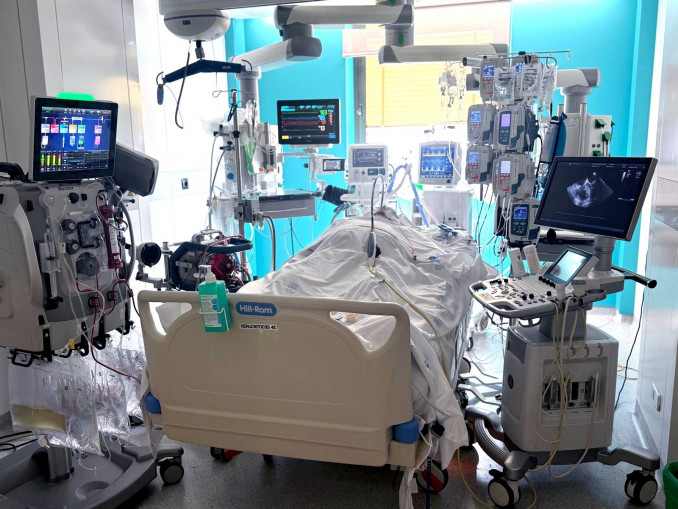 Canulación de paciente con soporte ECMO.